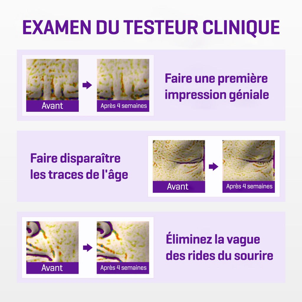 Some By MI - الصورة 4