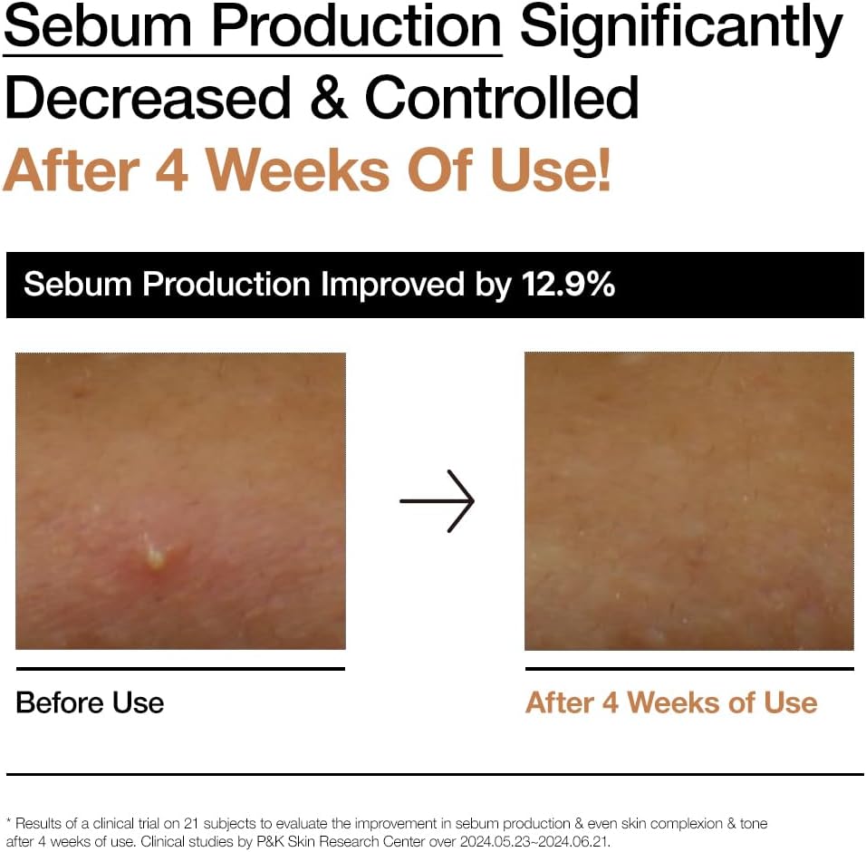 Anua RICE 70 GLOW MILKY TONER تونر التوهج بخلاصة الأرز - الصورة 4