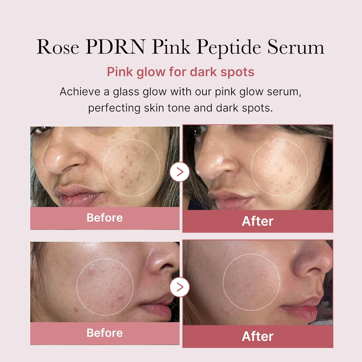 Medicube PDRN PINK PEPTIDE SERUM السيروم الوردي لتفتيح البشرة ومكافحة التجاعيد - الصورة 3