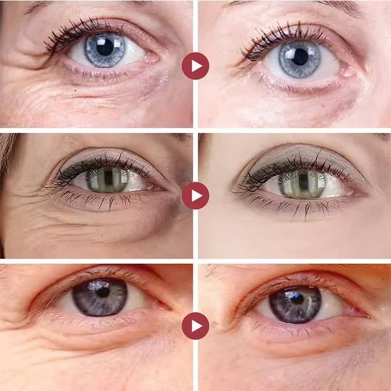 Collagen Eye Mask Remove Eyes Bag Anti Dark Circles Reduce Fine Lines Anti-Wrinkles Eye Patches Nourish Eye Care Korea Cosmetics - الصورة 5